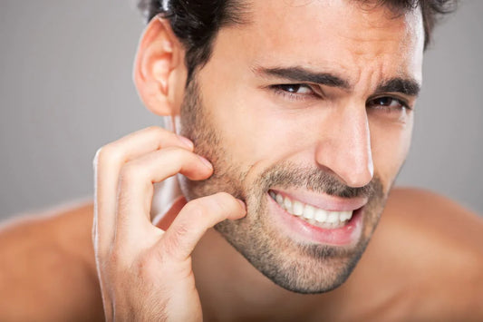 Beard Itching? Here’s Why You Need a Natural Beard Oil