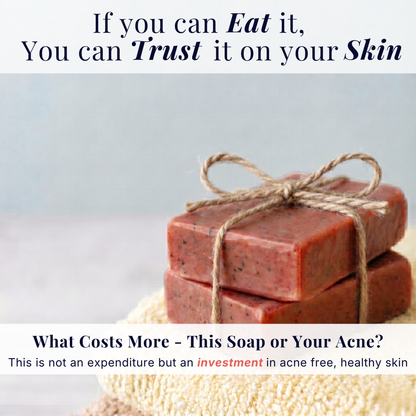 Acne Goat Milk Soap for Acne-Prone Skin with Lodh & Manjistha