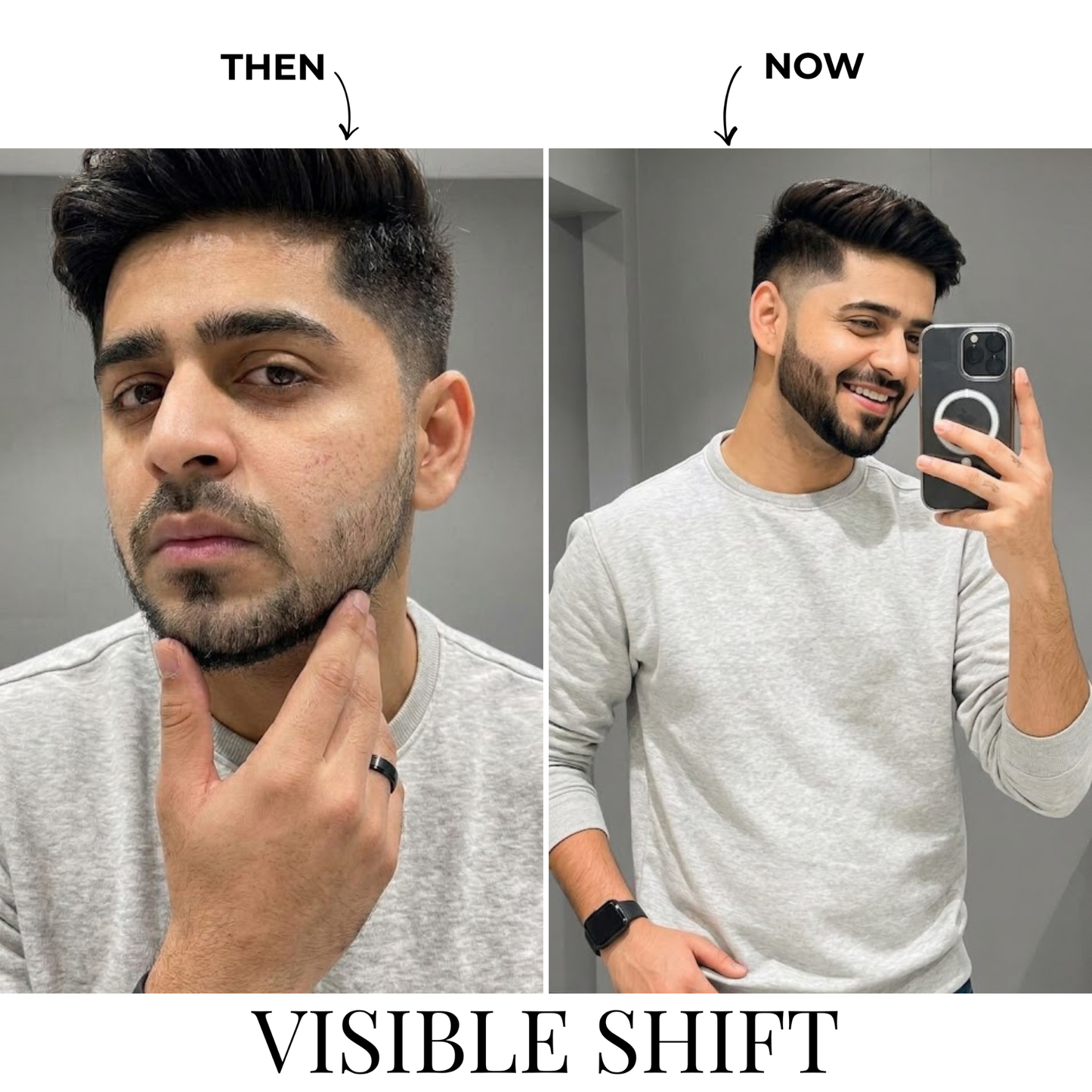 Best Ayurvedic Beard Growth Oil with Jojoba, Argan & Grapeseed to fight itch & dandruff